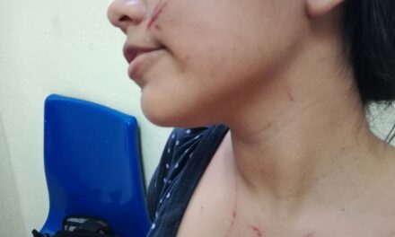 Adolescente agredida por resistirse a asalto en el barrio El Rosario, Chinandega